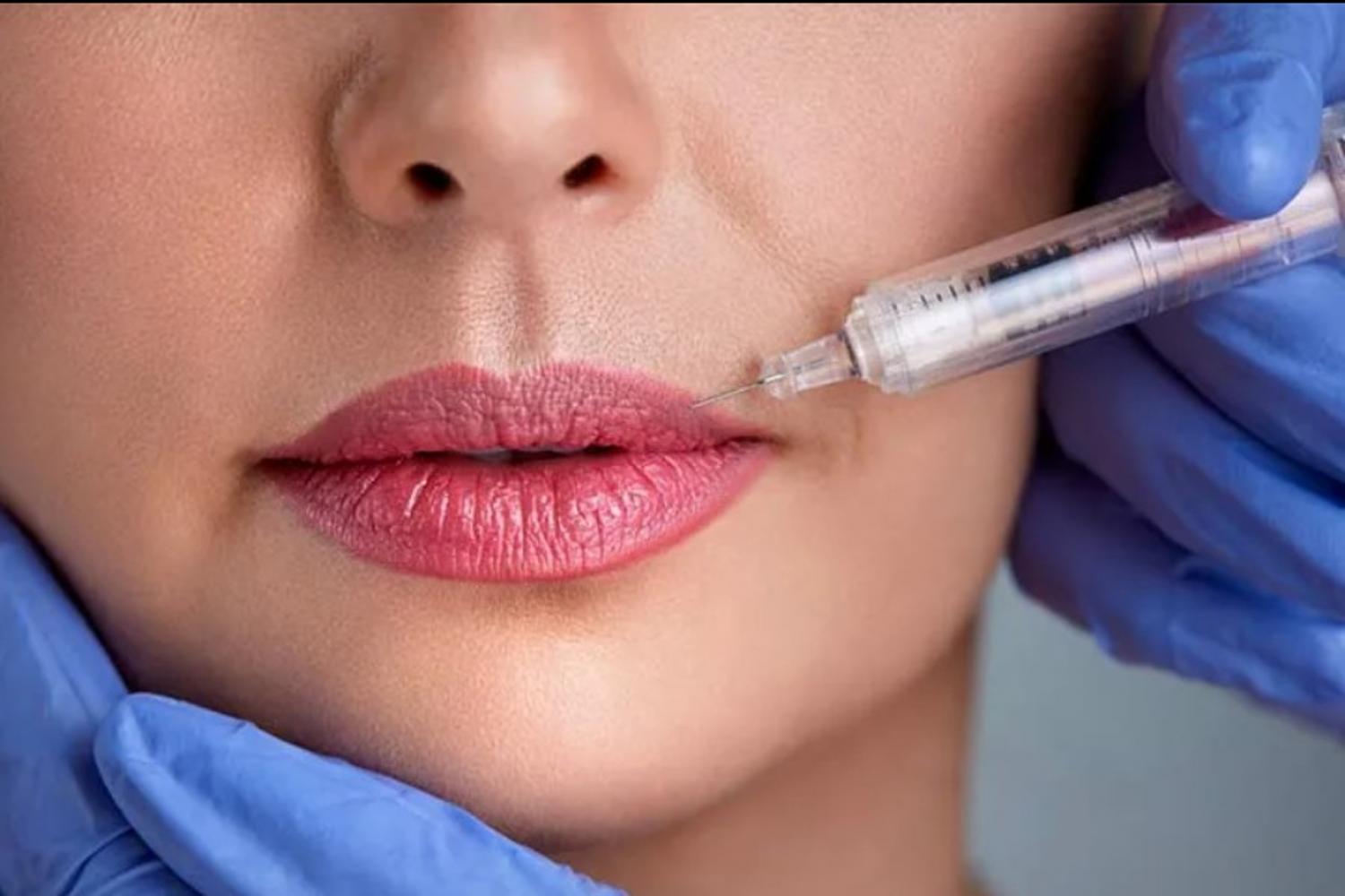 Что нельзя делать после введения филлеров в лицо Что нельзя делать после введения филлеров в лицо